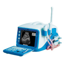 Digital Ultrasound Scanner/Ultrasound Machine